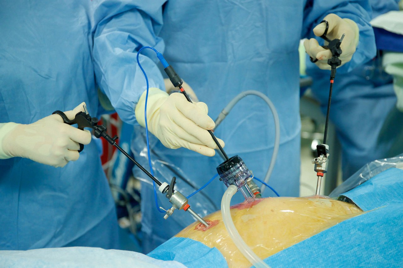 Laparoscopic Hernia Treatment in Ludhiana: A Safe and Effective Option