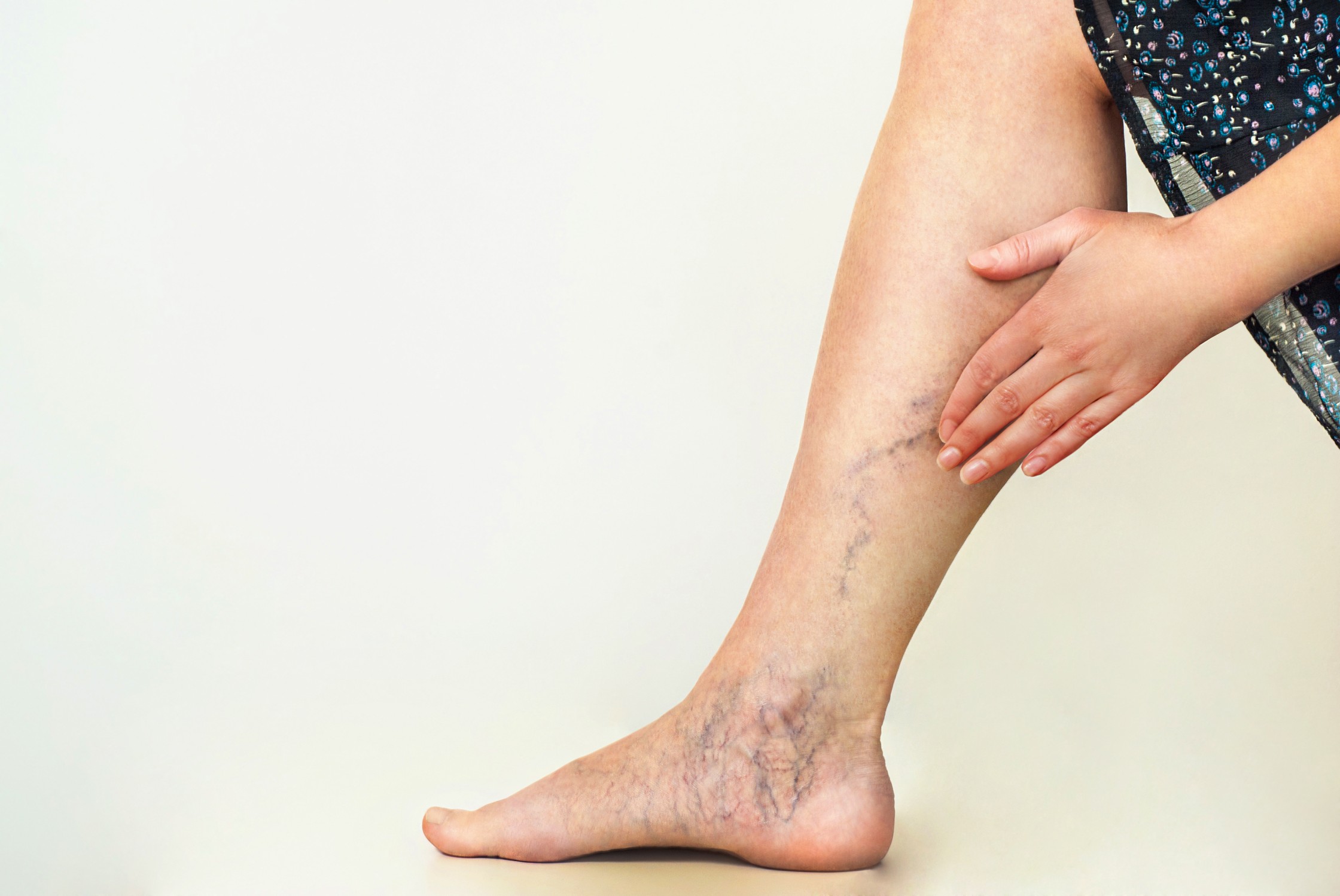 What Is A Vein Doctor Called And When To See A Vascular Doctor?