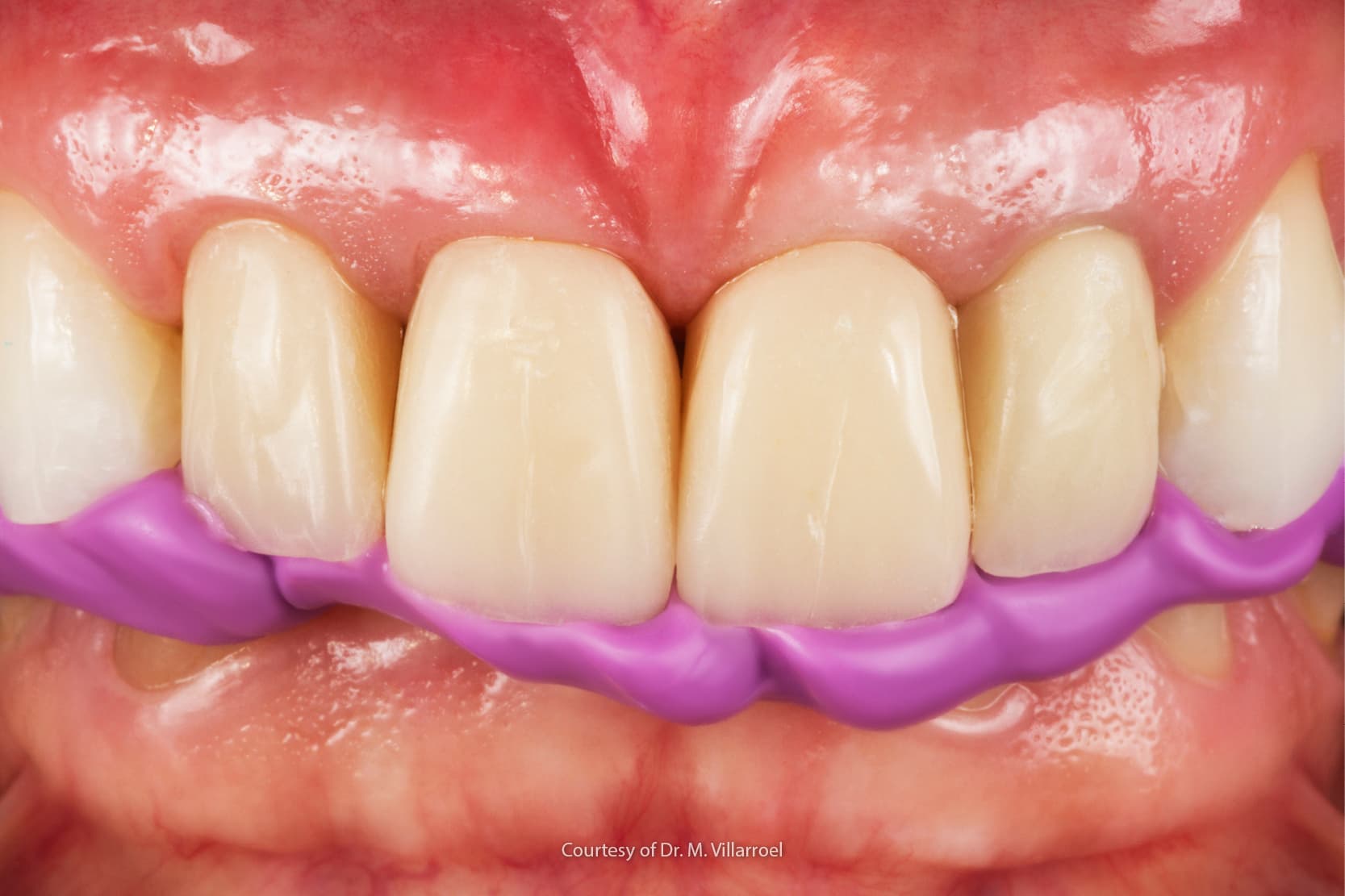 Looking for Tooth Extraction Near Me? Which Dentist in Houston Should You Choose?