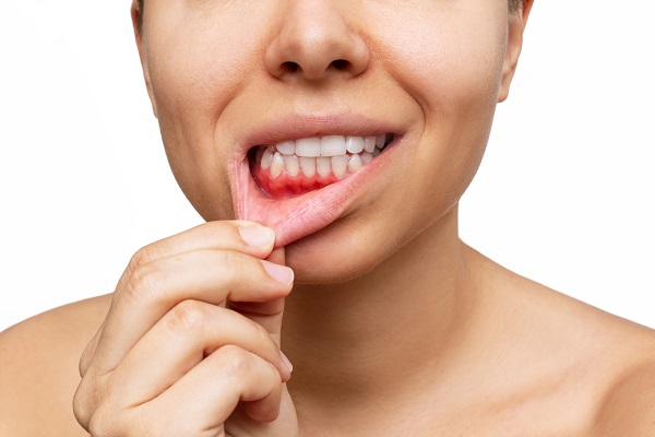 Explore Treatment Options and Cautions of Gum disease