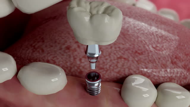 Transformative Your Smile with Richardson Cosmetic Dentist!